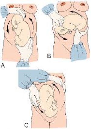 &Epsilon;&xi;&omega;&tau;&epsilon;&rho;&iota;&kappa;ό&sigmaf; &Mu;&epsilon;&tau;&alpha;&sigma;&chi;&eta;&mu;&alpha;&tau;&iota;&sigma;&mu;ό&sigmaf; &Iota;&sigma;&chi;&iota;&alpha;&kappa;&omicron;ύ &Epsilon;&mu;&beta;&rho;ύ&omicron;&upsilon; &sigma;&epsilon; &Kappa;&epsilon;&phi;&alpha;&lambda;&iota;&kappa;ό